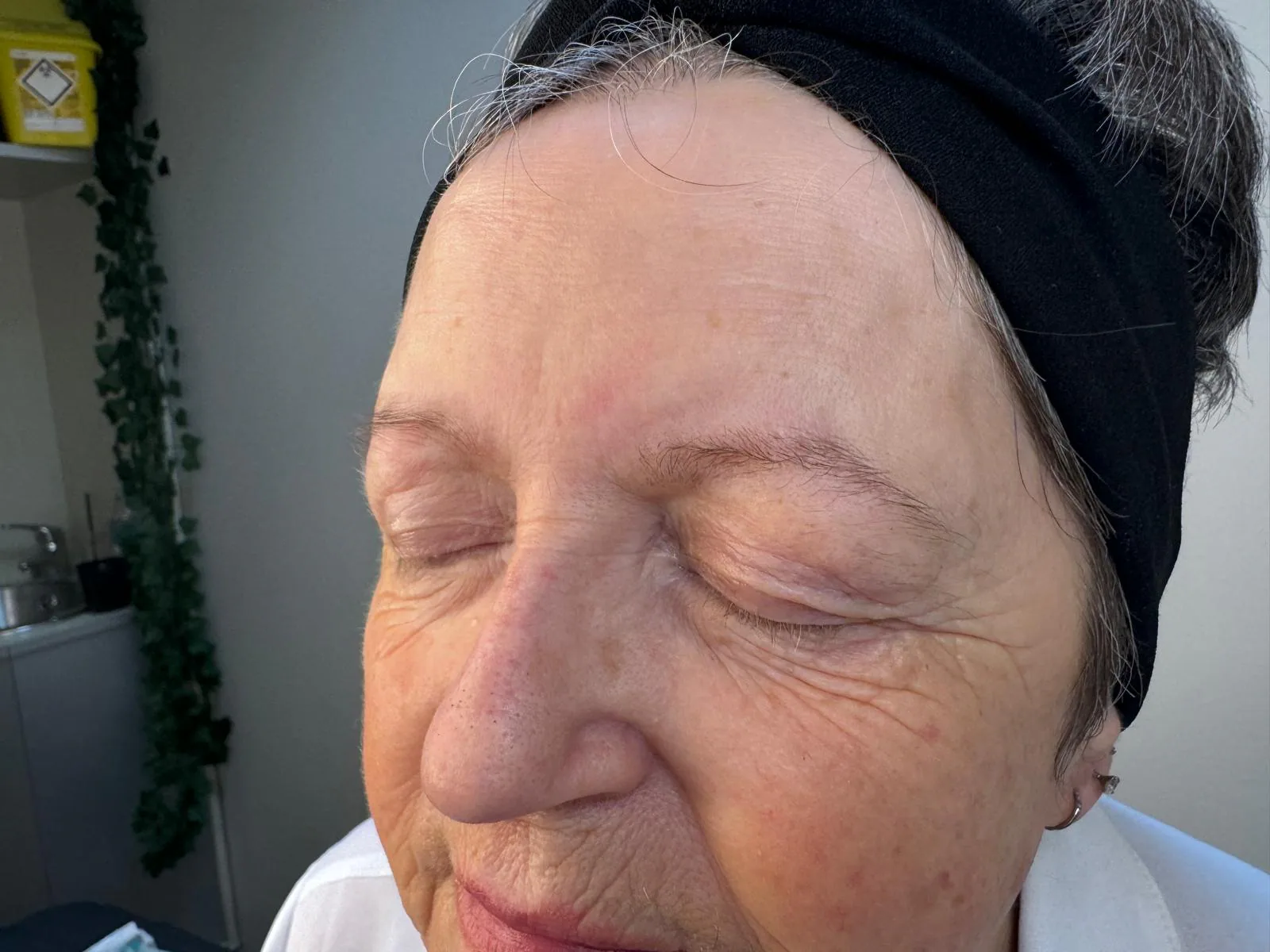 Before semi-permanent brow treatment, client result two